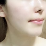 【敏感肌の方必見！】乃木坂46〇〇さん愛用の“赤ら顔・ニキビの赤み”が改善すると話題の方法とは・・・